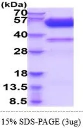 Human DcR2 / CD264 protein, human IgG1 Fc and His tag (active). GTX66967-pro