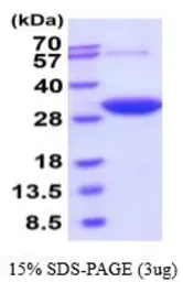 Human DCXR protein, His tag (active). GTX66968-pro