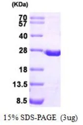 Human DHFR protein, His tag (active). GTX66969-pro