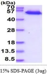 Human DR5 protein, human IgG1 Fc and His tag (active). GTX66972-pro