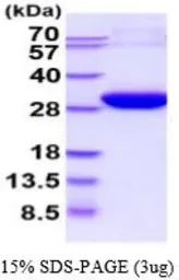 Human ECHS1 protein, His tag (active). GTX66976-pro
