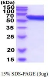 Mouse ERp57 protein, His tag (active). GTX66986-pro