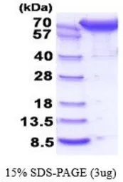 Human ERP72 protein, His tag (active). GTX66987-pro