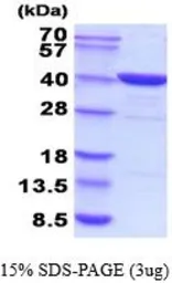 Human FBP1 protein, His tag (active). GTX66988-pro