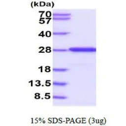 Human FKBP14 protein, His tag (active). GTX66991-pro