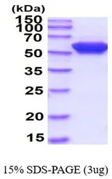 Human FKBP4 protein, His tag (active). GTX66995-pro