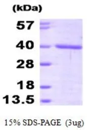 Human FKBP6 protein, His tag (active). GTX66996-pro