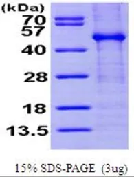 Human FKBPL protein, His tag (active). GTX66997-pro