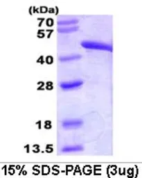 Human Fumarate hydratase protein (active). GTX66998-pro