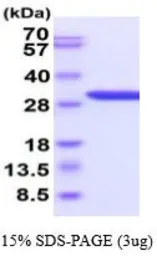 Human Galectin 3 protein, His tag (active). GTX67001-pro