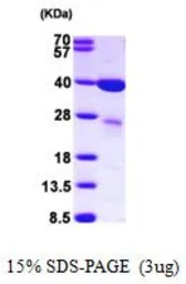 Human Galectin 8 protein, His tag (active). GTX67003-pro