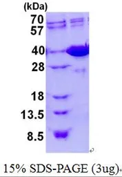 Mouse Galectin4 protein, His tag (active). GTX67007-pro