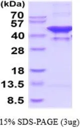 Human Glutamine synthetase protein, His tag (active). GTX67012-pro
