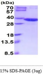Human GNMT protein, His tag (active). GTX67019-pro