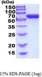 Human GPI protein, His tag (active). GTX67023-pro
