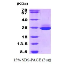 Human GSTA1 protein (active). GTX67032-pro