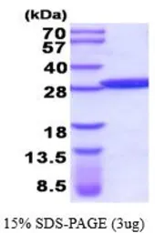 Human GSTM5 protein, His tag (active). GTX67039-pro