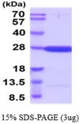 Human Guanylate kinase protein, His tag (active). GTX67045-pro