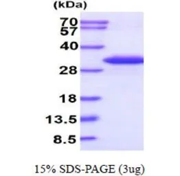 Human HAGH protein, His tag (active). GTX67046-pro