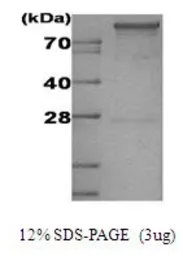 Human Hexokinase 1 protein, His tag (active). GTX67047-pro