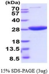 Human HPRT protein, His tag (active). GTX67051-pro