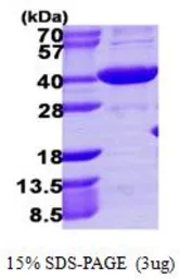 Human HSD3a protein, His tag (active). GTX67052-pro