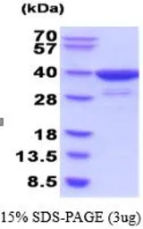 Human HSD3a protein (active). GTX67053-pro