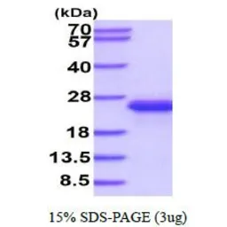 Mouse IL33 protein, His tag (active). GTX67065-pro