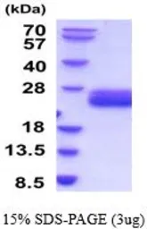 Mouse IL6 protein, His tag (active). GTX67072-pro