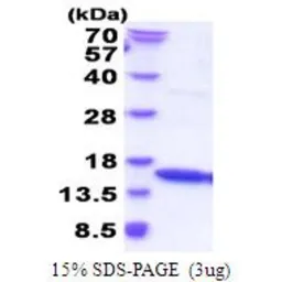 Human Interferon gamma protein (active). GTX67078-pro