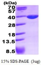 Human LDHA protein, His tag (active). GTX67081-pro