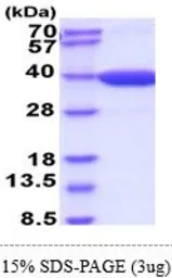 Mouse MDH2 protein, His tag (active). GTX67092-pro