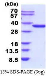 Human NMNAT1 protein, His tag (active). GTX67099-pro