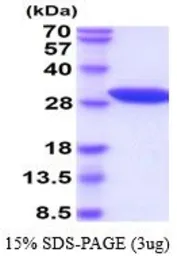 Human NNMT protein, His tag (active). GTX67100-pro