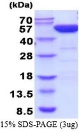 Human PGD protein, His tag (active). GTX67113-pro