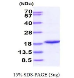 Human PPIL1 protein, His tag (active). GTX67131-pro