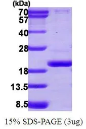 Human PPIL3 protein, His tag (active). GTX67133-pro
