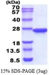 Human Prolactin protein (active). GTX67139-pro