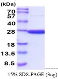 Mouse PRX II protein, His tag (active). GTX67145-pro