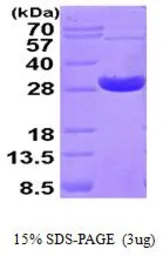 Human PRX IV protein, His tag (active). GTX67147-pro
