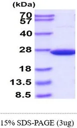 Human SOD2 protein, His tag (active). GTX67156-pro