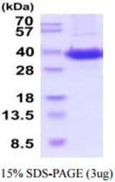 Human Sodium/Potassium ATPase beta 1 protein, His tag (active). GTX67157-pro