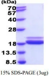Mouse TNF alpha protein, His tag (active). GTX67166-pro