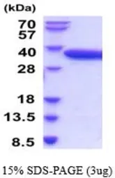 Human TRAP protein, His tag (active). GTX67172-pro