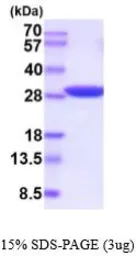 Human Triosephosphate isomerase protein, His tag (active). GTX67174-pro