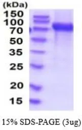 Human VCAM1 / CD106 protein, His tag (active). GTX67183-pro