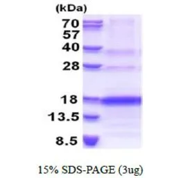 Human VEGF121 protein, His tag (active). GTX67185-pro