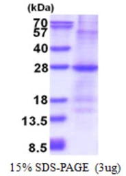 Human GSTM1 protein, His tag. GTX67439-pro
