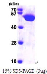 Human HARS protein, His tag. GTX67451-pro
