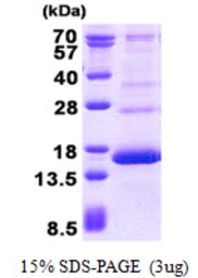 Human Hemoglobin gamma 2 protein, His tag. GTX67454-pro